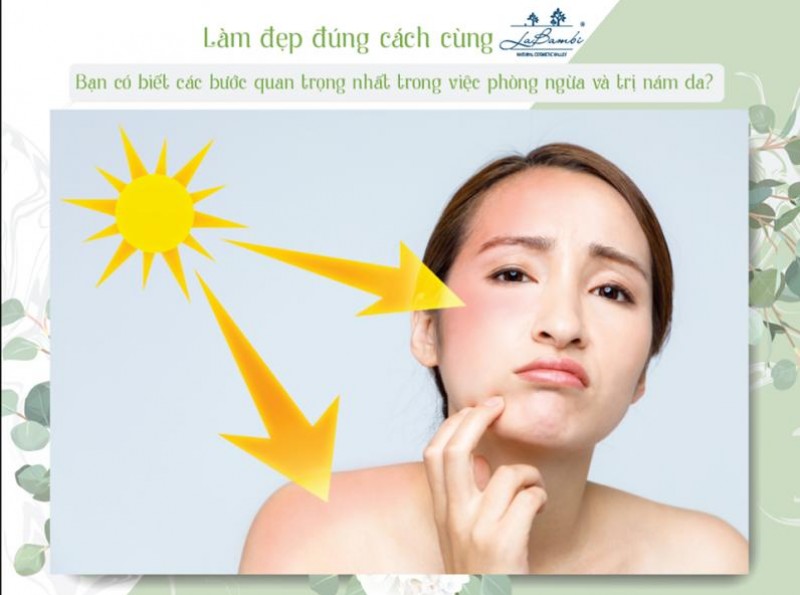 MINIGAME: LÀM ĐẸP ĐÚNG CÁCH CÙNG LABAMBI 