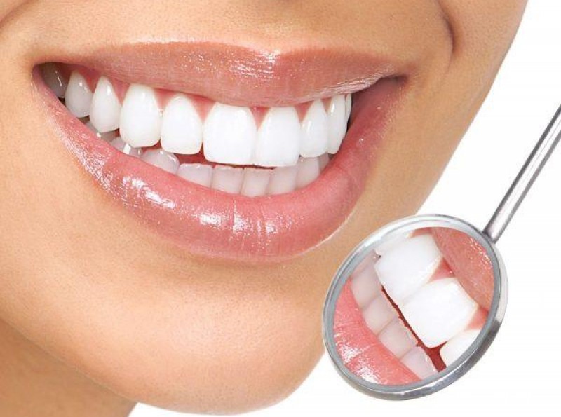 Phương pháp thẩm mỹ răng nào an toàn và được lựa chọn nhiều nhất?
