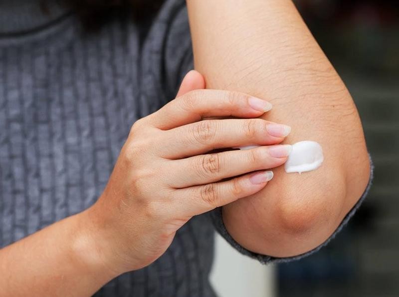Khuỷu tay sạm xỉn, làm sao tự tin?