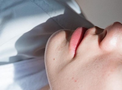 Môi không khô, nhưng vùng da quanh miệng lại bị khô thì phải làm sao?
