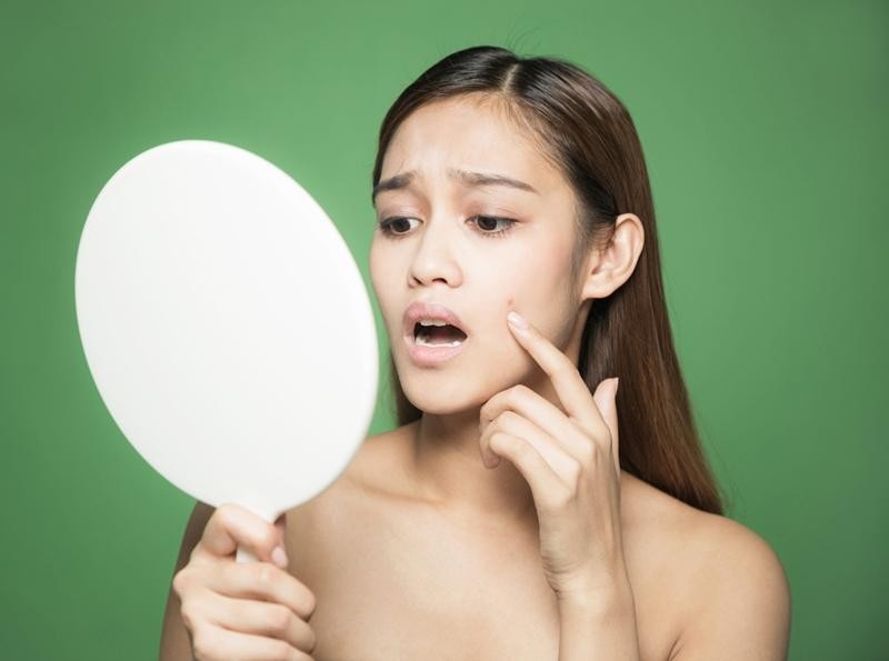 Những hiểu lầm khiến bạn trị mụn không thành công