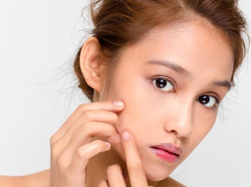 Gửi những cô nàng định nặn mụn: Biết địch biết ta, trăm trận trăm thắng