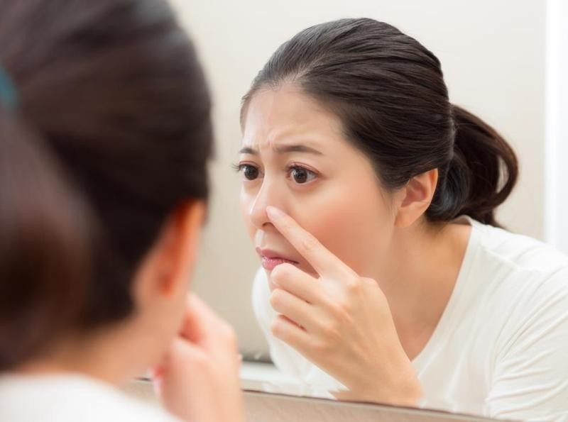 “Vũ khí” nào diệt mụn đầu trắng hiệu quả?