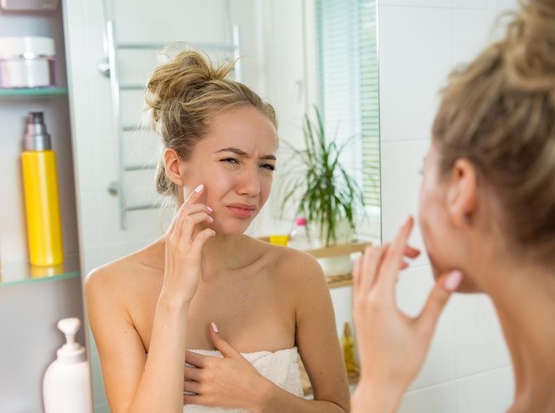 Quy trình chăm sóc siêu đơn giản cho làn da tuổi dậy thì