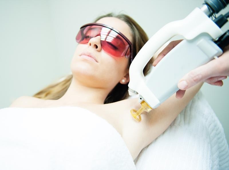 Triệt lông bằng laser hay waxing thì đỡ đau hơn?