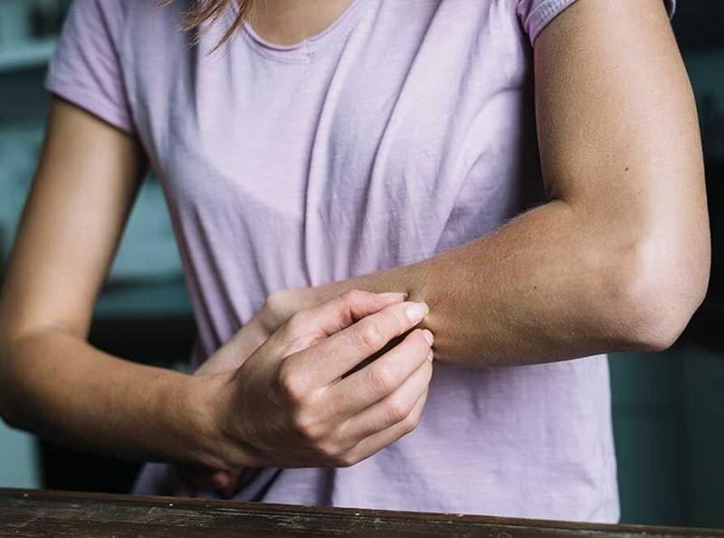 Phải làm gì khi da mẩn ngứa vì ăn kiêng theo chế độ Keto?