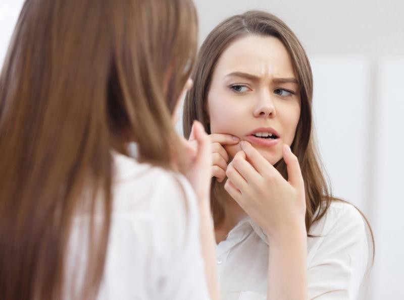Bạn có thể tự tin khi hẹn hò với mặt mụn?