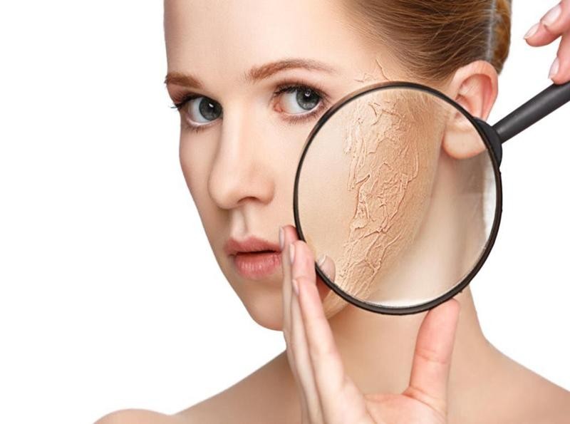 Đừng để làn da “kêu cứu” chỉ vì bạn quá lười uống nước vào mùa đông
