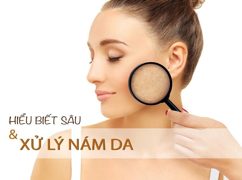 Hiểu biết và xử lý nám da